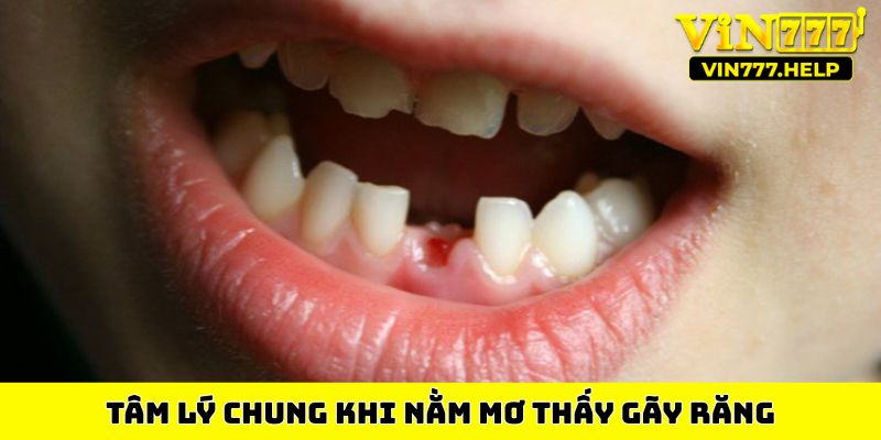 Tâm lý chung khi nằm mơ thấy gãy răng